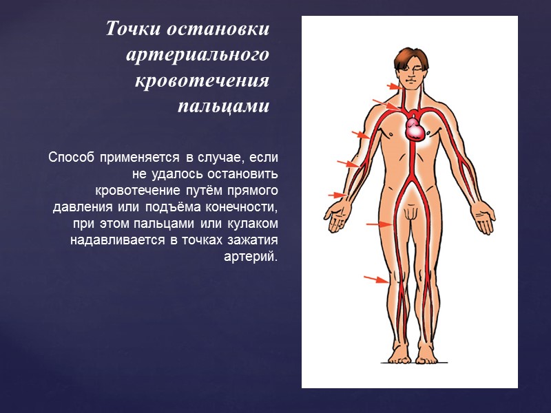 Наложение повязок на разные части тела при венозном и капиллярном кровотечении Существует огромное множество