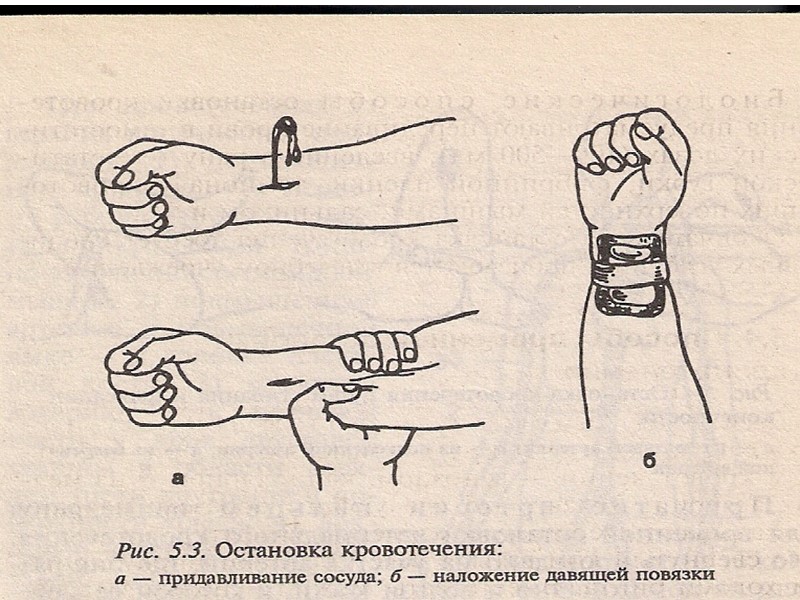 Медицинской наукой и практикой доказано, что в некоторых случаях смертельных исходов можно избежать только