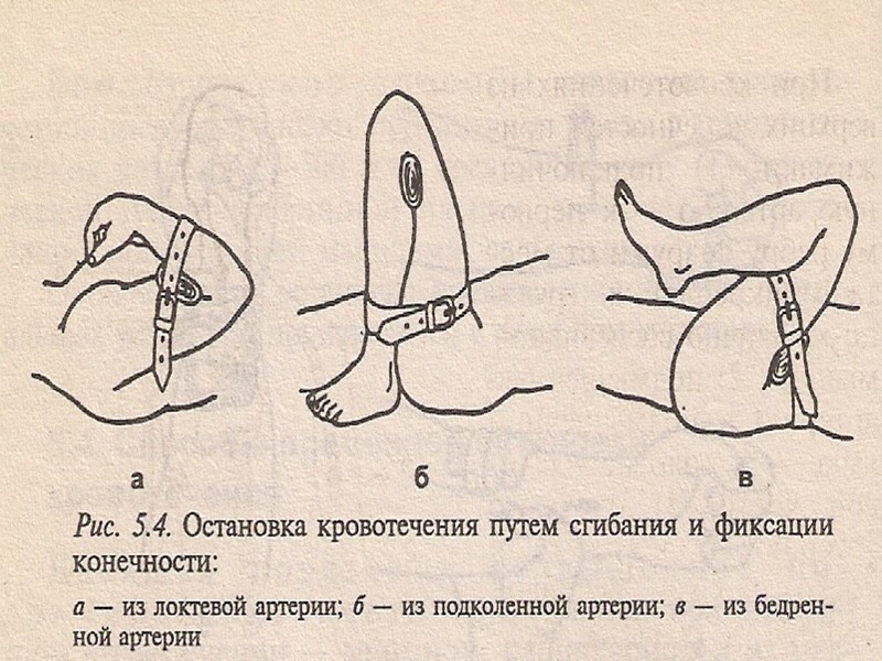 Оказание помощи: Сердечно-легочная реанимация Дорожно-транспортные происшествия Ожоги Обморожения Электротравмы Утопление Тепловой и солнечный перегрев