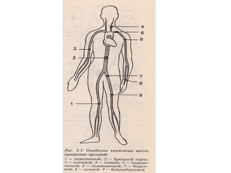 Сердечно-легочная реанимация Диагностические признаки наступления клинической смерти считаются: Отсутствие дыхания Исчезновение пульса на крупных