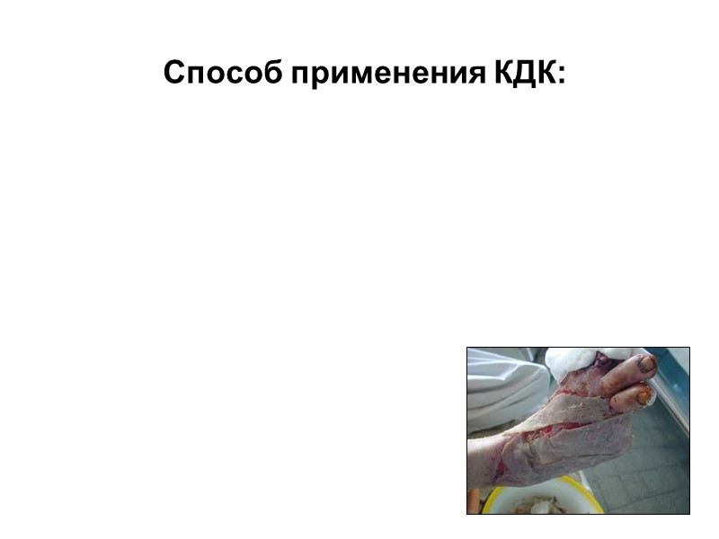 3-и СУТКИ 4-е СУТКИ Флегмона  1-е СУТКИ