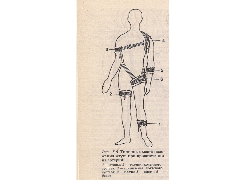 Реанимационные мероприятия для восстановления проходимости дыхательных путей:  А) искусственная вентиляция легких (рот-в-рот; рот-в-нос)