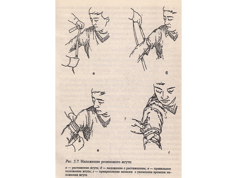 Первая помощь при ДТП Вызвать скорую 03 Вызвать полицию 02 В случае пожара, кровотечения,