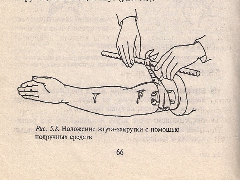 Первая помощь при кровоточащих ранах Остановить кровотечение Предохранить рану от инфицирования Саму рану не