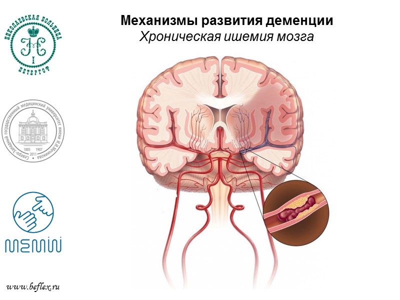 Нейромедиаторы  www.beflex.ru