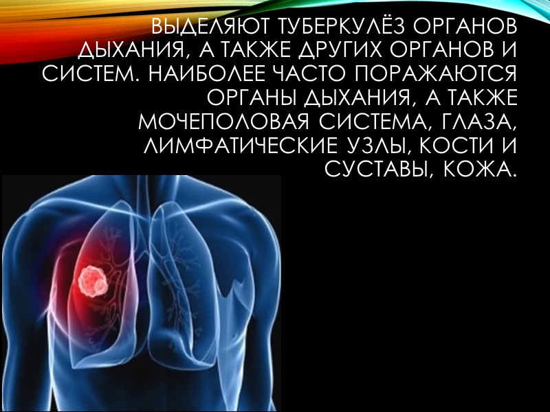 Туберкулёз — болезнь, вызываемая у человека и животных микобактериями туберкулёза.