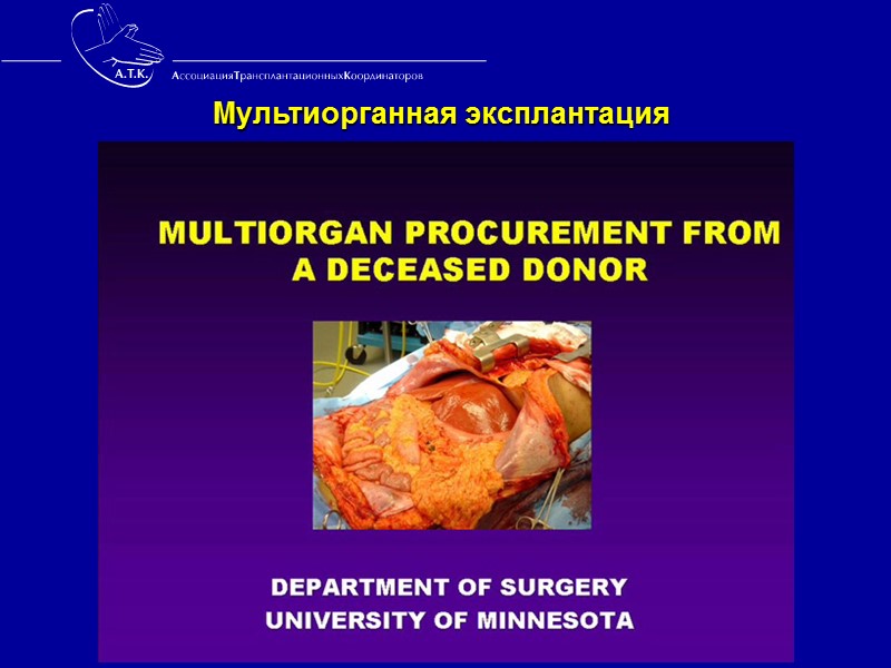 Кто является трансплантационным координатором в Испании? 75,7% - врачи интенсивных отделений,  86% ТК