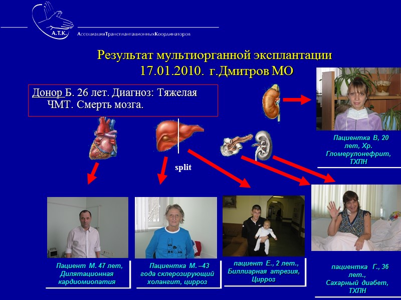 Основные понятия органного донорства Потенциальный донор - пациент с доказанным инкурабельным поражением головного мозга,