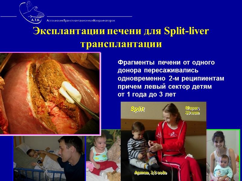 Владимир Петрович Демихов – учёный-экспериментатор, основоположник мировой трансплантологии Впервые в мире выполнил следующие операции