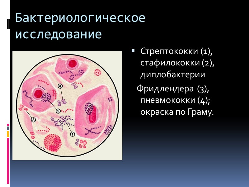 Наличие различных включений.    фибринозные свертки —древовидно разветвленные образования   беловатого