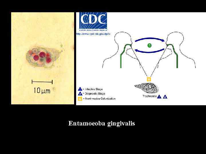 Entamoeoba gingivalis 