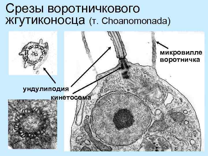 Срезы воротничкового жгутиконосца (т. Choanomonada) микровилле воротничка ундулиподия кинетосома 