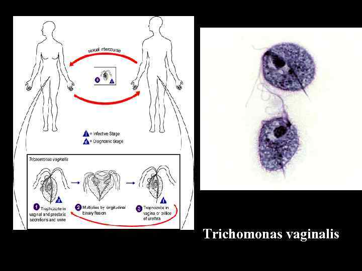 Trichomonas vaginalis 