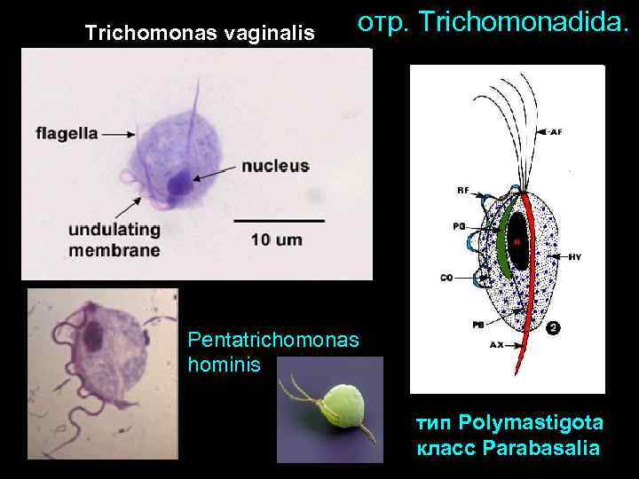 Trichomonas vaginalis отр. Trichomonadida. Pentatrichomonas hominis тип Polymastigota класс Parabasalia 