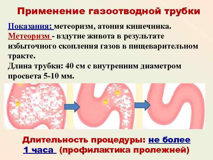 Газоотводная трубка презентация