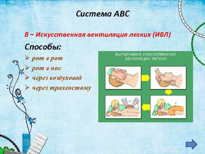 Система АВС В – Искусственная вентиляция легких (ИВЛ) Способы: Ø Ø рот в нос
