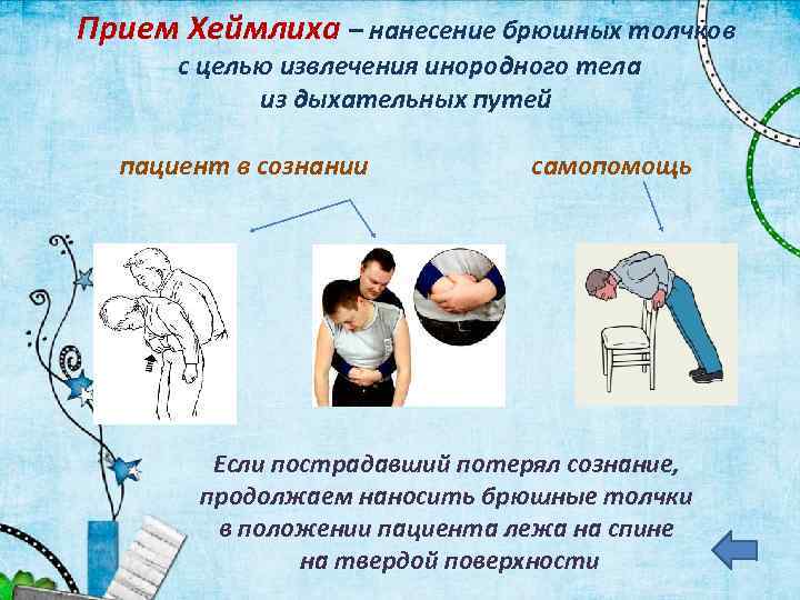 Прием Хеймлиха – нанесение брюшных толчков с целью извлечения инородного тела из дыхательных путей