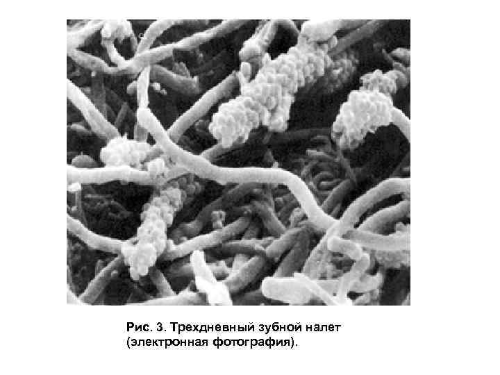 Фото микробы в зубах