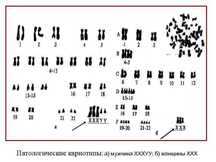 Нарисуйте кариотипы здоровых мужчины и женщины