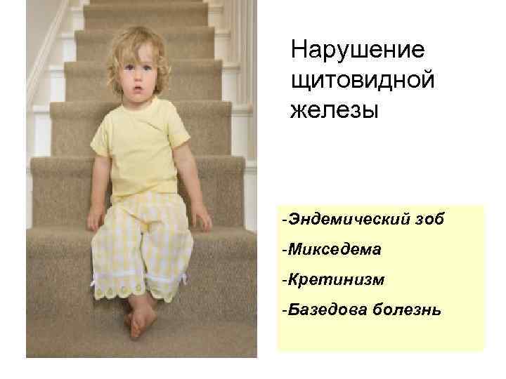 Нарушение щитовидной железы -Эндемический зоб -Микседема -Кретинизм -Базедова болезнь 