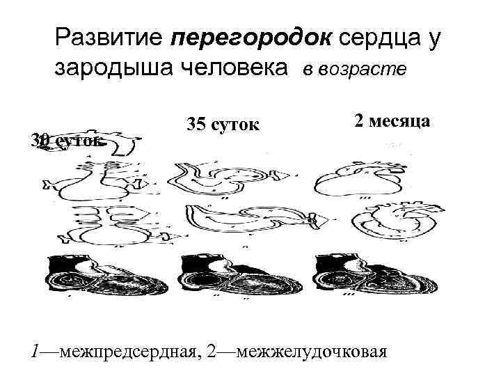 Развитие перегородок сердца у зародыша человека в возрасте 30 суток 35 суток 2 месяца