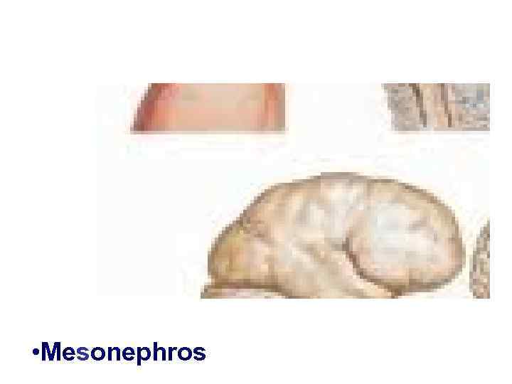  • Mesonephros 