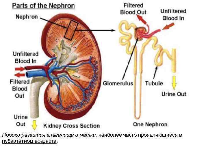 Пороки развития влагалища и матки, наиболее часто проявляющиеся в пубертатном возрасте. 