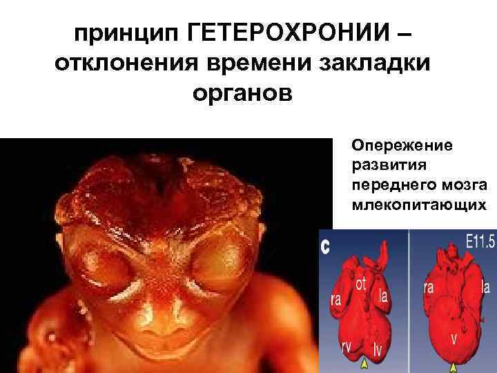принцип ГЕТЕРОХРОНИИ – отклонения времени закладки органов Опережение развития переднего мозга млекопитающих 