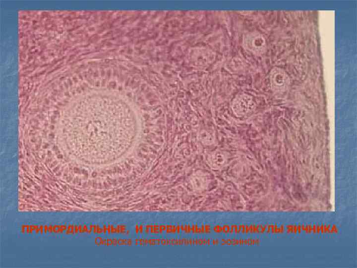 ПРИМОРДИАЛЬНЫЕ, И ПЕРВИЧНЫЕ ФОЛЛИКУЛЫ ЯИЧНИКА Окраска гематоксилином и эозином 