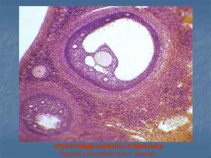 ВТОРИЧНЫЙ ФОЛЛИКУЛ ЯИЧНИКА Окраска гематоксилином и эозином 