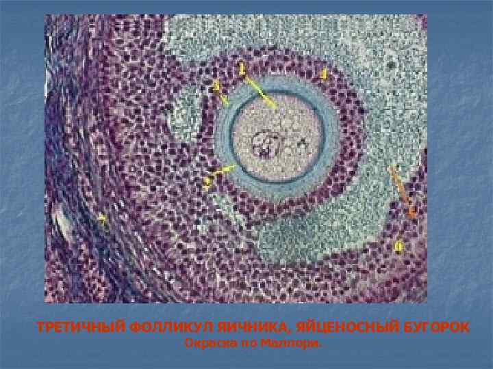 ТРЕТИЧНЫЙ ФОЛЛИКУЛ ЯИЧНИКА, ЯЙЦЕНОСНЫЙ БУГОРОК Окраска по Маллори. 