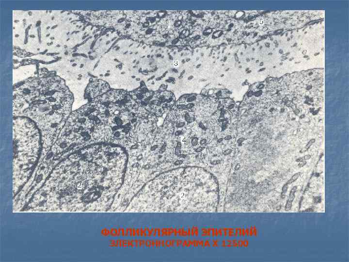 ФОЛЛИКУЛЯРНЫЙ ЭПИТЕЛИЙ ЭЛЕКТРОННОГРАММА Х 12500 