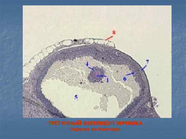 ТРЕТИЧНЫЙ ФОЛЛИКУЛ ЯИЧНИКА Окраска по Маллори. 