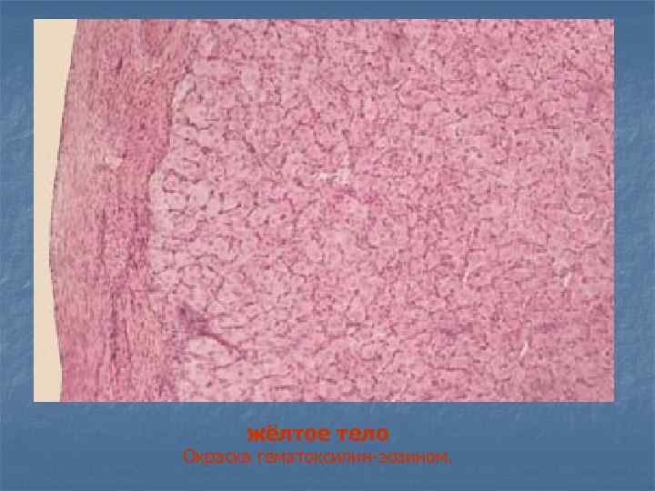 жёлтое тело Окраска гематоксилин-эозином. 