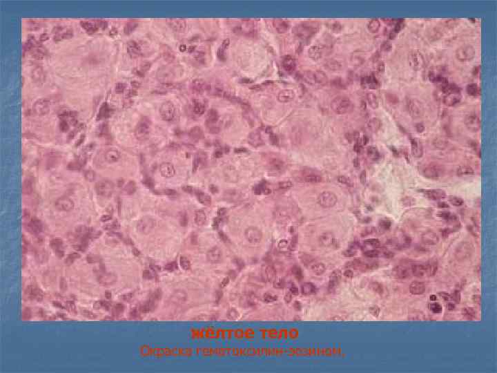 жёлтое тело Окраска гематоксилин-эозином. 