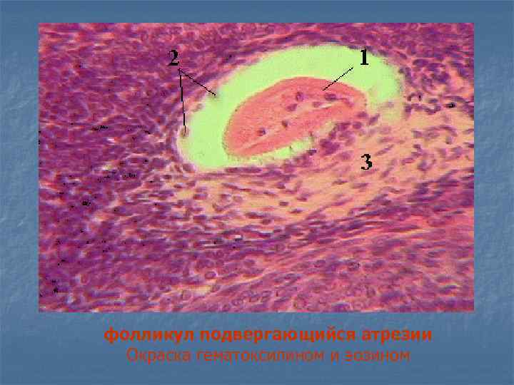 фолликул подвергающийся атрезии Окраска гематоксилином и эозином 