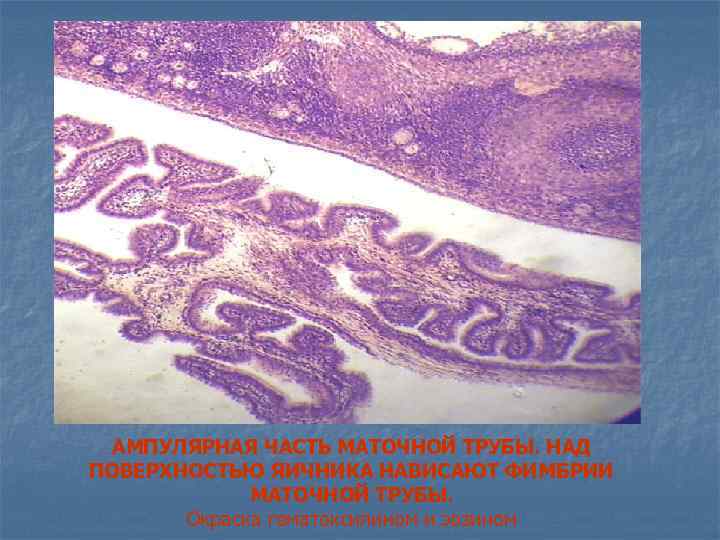 АМПУЛЯРНАЯ ЧАСТЬ МАТОЧНОЙ ТРУБЫ. НАД ПОВЕРХНОСТЬЮ ЯИЧНИКА НАВИСАЮТ ФИМБРИИ МАТОЧНОЙ ТРУБЫ. Окраска гематоксилином и