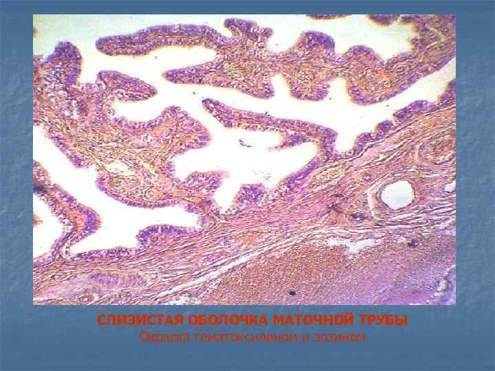 СЛИЗИСТАЯ ОБОЛОЧКА МАТОЧНОЙ ТРУБЫ Окраска гематоксилином и эозином 