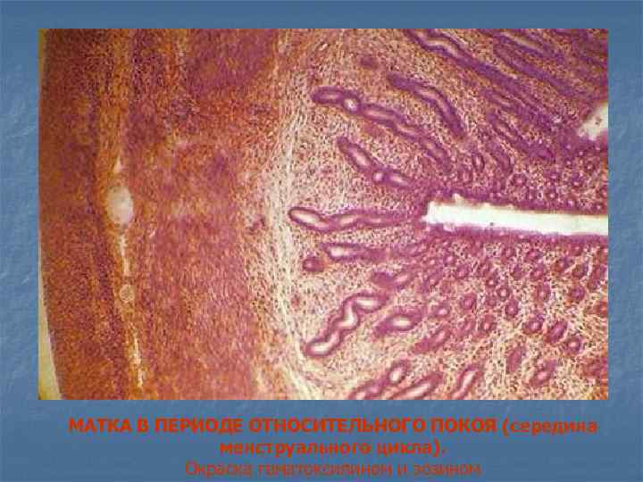 МАТКА В ПЕРИОДЕ ОТНОСИТЕЛЬНОГО ПОКОЯ (середина менструального цикла). Окраска гематоксилином и эозином 