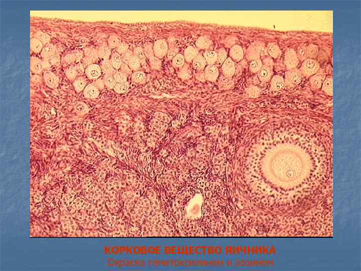 КОРКОВОЕ ВЕЩЕСТВО ЯИЧНИКА Окраска гематоксилином и эозином 
