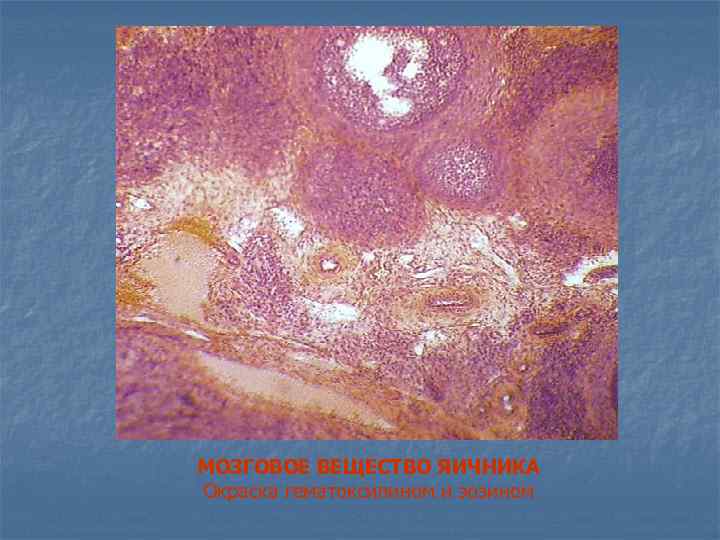 МОЗГОВОЕ ВЕЩЕСТВО ЯИЧНИКА Окраска гематоксилином и эозином 
