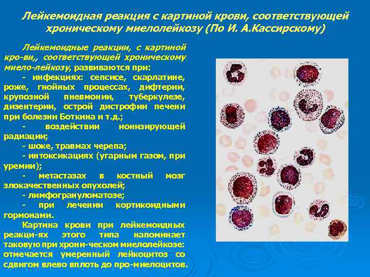 Картина крови при хроническом миелолейкозе