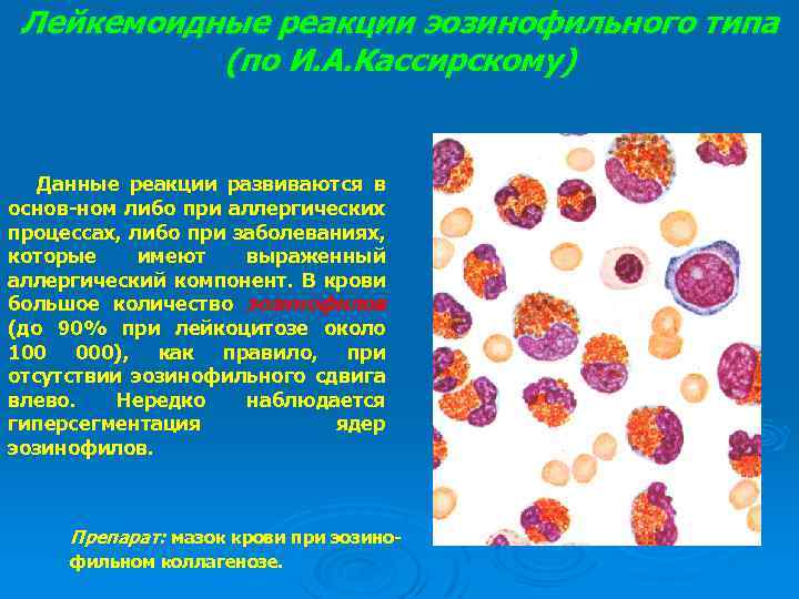 Лейкемоидные реакции эозинофильного типа (по И. А. Кассирскому) Данные реакции развиваются в основ-ном либо