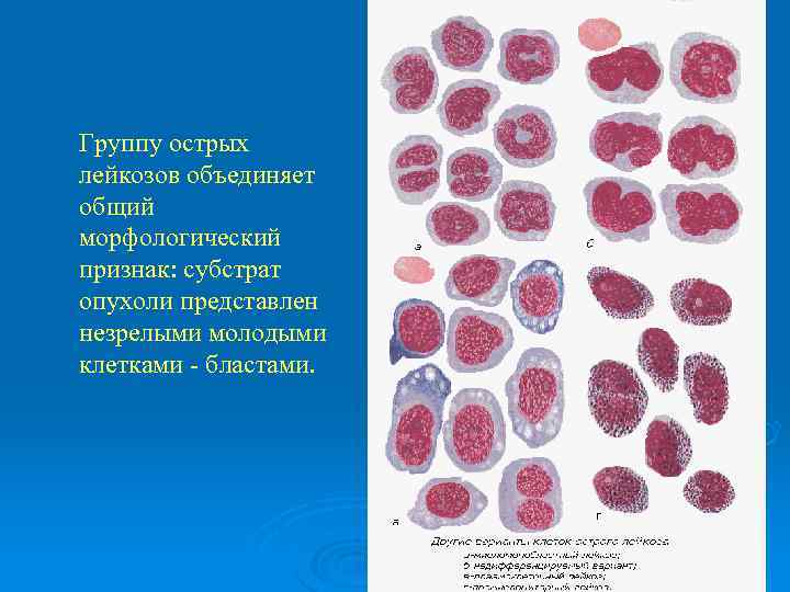 Виды острых лейкозов характеристика картины крови при них