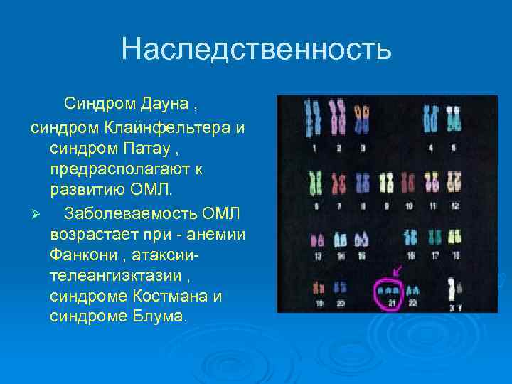 Наследственность Синдром Дауна , синдром Клайнфельтера и синдром Патау , предрасполагают к развитию ОМЛ.