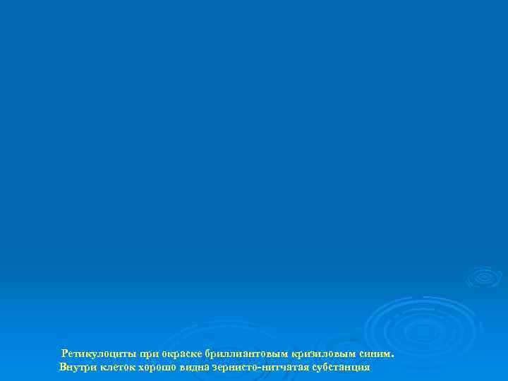  Ретикулоциты при окраске бриллиантовым кризиловым синим. Внутри клеток хорошо видна зернисто-нитчатая субстанция 