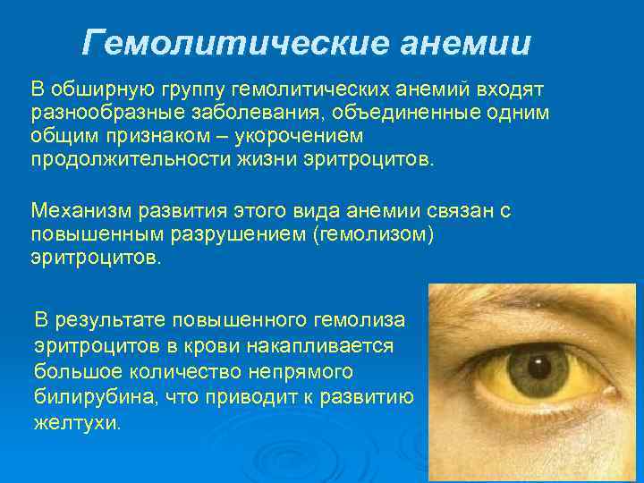Гемолитические анемии В обширную группу гемолитических анемий входят разнообразные заболевания, объединенные одним общим признаком