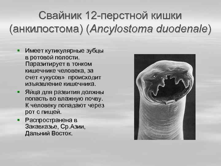 Свайник 12 -перстной кишки (анкилостома) (Ancylostoma duodenale) § Имеет кутикулярные зубцы в ротовой полости.