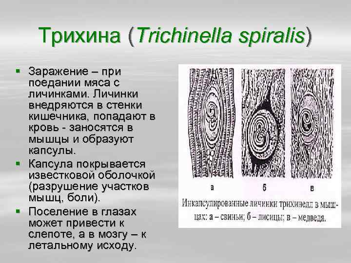 Личинки трихинеллы. Инкапсулированные личинки трихинеллы (Trichinella spiralis). Вид трихинелла Спиралис. Трихинелла Спиралис капсула. Трихинелла Спиралис строение личинки.