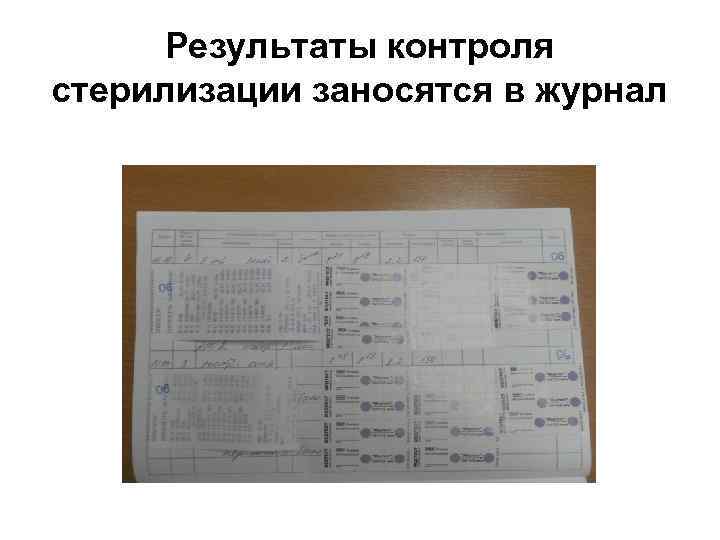 Результаты контроля стерилизации заносятся в журнал 
